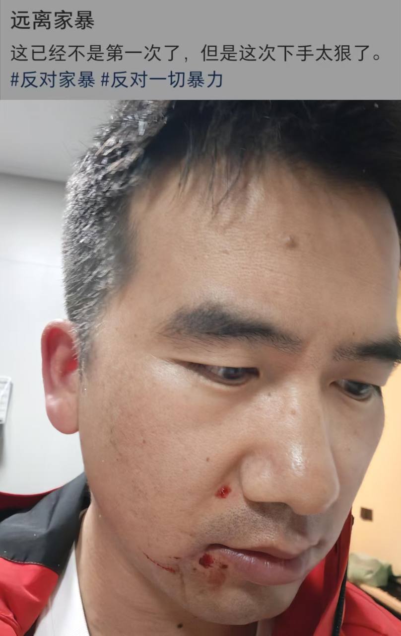 吃瓜热点 配图